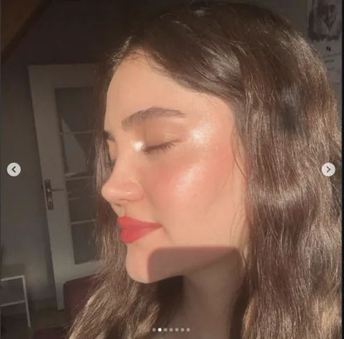 Rhinoplasty