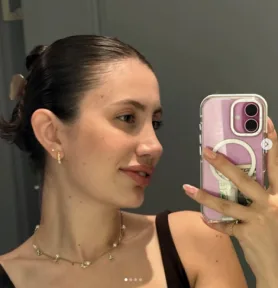 Rhinoplasty